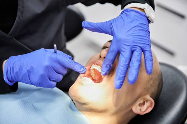 Best Knocked-Out Tooth (Avulsed Tooth) Treatment in Madisonville, LA